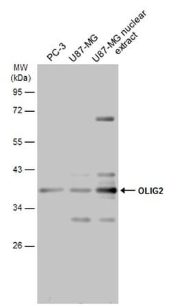 OLIG2 Polyclonal Antibody:Antibodies, Polyclonal