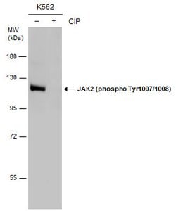 Invitrogen Phospho-JAK2 (Tyr1007, Tyr1008) Polyclonal Antibody 100 &mu;L;