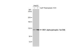 Invitrogen Phospho-IRE1 alpha (Ser724) Polyclonal Antibody 100 &mu;L; Unconjugated:Antibodies,