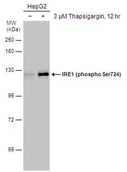 Invitrogen Phospho-IRE1 alpha (Ser724) Polyclonal Antibody 100 &mu;L; Unconjugated:Antibodies,