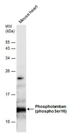 Invitrogen Phospho-Phospholamban (Ser16) Polyclonal Antibody 100 &mu;L;