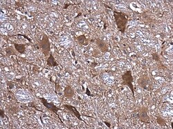 Invitrogen NMDAR1 Polyclonal Antibody 100 &mu;L; Unconjugated:Antibodies,