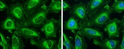 Invitrogen IP3 Receptor 1 Polyclonal Antibody 100 &mu;L; Unconjugated:Antibodies,