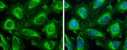 Invitrogen IP3 Receptor 1 Polyclonal Antibody 100 &mu;L; Unconjugated:Antibodies,