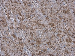 Invitrogen MAP2 Polyclonal Antibody 100 &mu;L; Unconjugated:Antikroppar