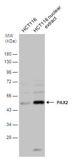 Invitrogen Phospho-PAX2 (Ser393) Polyclonal Antibody 100 &mu;L; Unconjugated:Antibodies,
