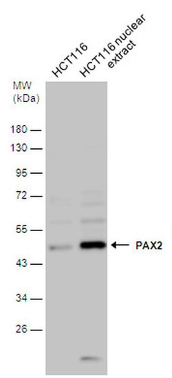 Invitrogen Phospho-PAX2 (Ser393) Polyclonal Antibody 100 &mu;L; Unconjugated:Antibodies,
