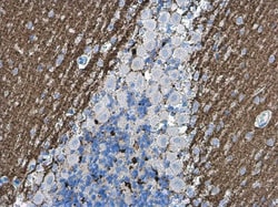 Invitrogen VGLUT1 Polyclonal Antibody 100 &mu;L; Unconjugated:Anticuerpos