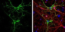 Invitrogen Aquaporin 4 Polyclonal Antibody 100 &mu;L; Unconjugated:Antibodies,