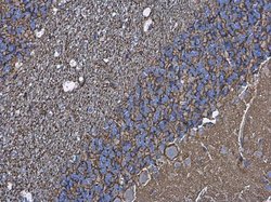 Invitrogen Aquaporin 4 Polyclonal Antibody 100 &mu;L; Unconjugated:Antibodies,