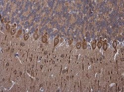 Invitrogen PSD-95 Polyclonal Antibody 100 &mu;L; Unconjugated:Antibodies,
