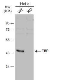Invitrogen TBP Polyclonal Antibody 100 &mu;L; Unconjugated:Antibodies