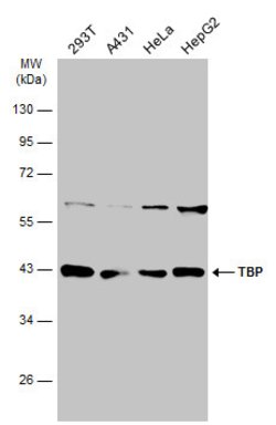 Invitrogen TBP Polyclonal Antibody 100 &mu;L; Unconjugated:Antibodies