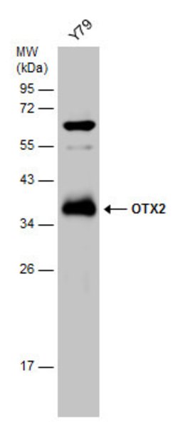 Invitrogen OTX2 Polyclonal Antibody 100 &mu;L | Buy Online | Invitrogen&trade; | Fisher Scientific