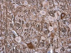 Invitrogen NEFM Polyclonal Antibody 100 &mu;L; Unconjugated:Antibodies,