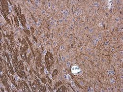 Invitrogen NEFM Polyclonal Antibody 100 &mu;L; Unconjugated:Antibodies,