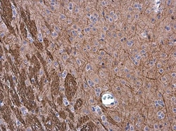 Invitrogen NEFM Polyclonal Antibody 100 &mu;L; Unconjugated:Antibodies,