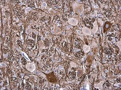 Invitrogen NEFM Polyclonal Antibody 100 &mu;L; Unconjugated:Antibodies,