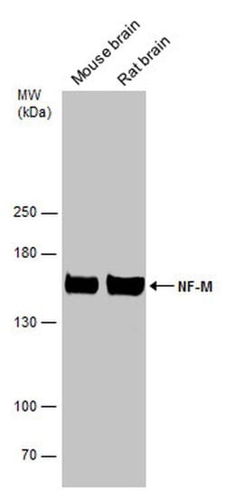 Invitrogen NEFM Polyclonal Antibody 100 &mu;L; Unconjugated:Antibodies,