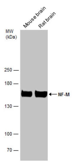 Invitrogen NEFM Polyclonal Antibody 100 &mu;L; Unconjugated:Antibodies,