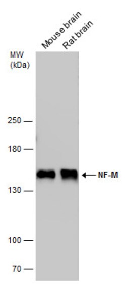 Invitrogen NEFM Polyclonal Antibody 100 &mu;L; Unconjugated:Antibodies,