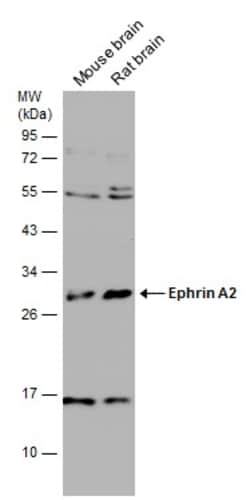 Invitrogen Ephrin A2 Polyclonal Antibody 100 &mu;L | Buy Online | Invitrogen&trade; | Fisher Scientific