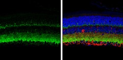 Invitrogen VAMP2 Polyclonal Antibody 100 &mu;L; Unconjugated:Antibodies,