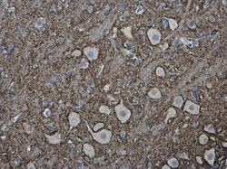 Invitrogen VAMP2 Polyclonal Antibody 100 &mu;L; Unconjugated:Antibodies,