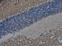 Invitrogen VAMP2 Polyclonal Antibody 100 &mu;L; Unconjugated:Antibodies,