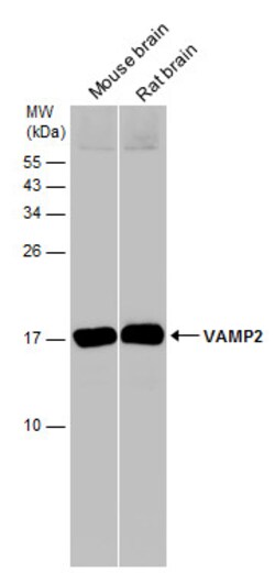 Invitrogen VAMP2 Polyclonal Antibody 100 &mu;L; Unconjugated:Antibodies,