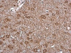 Invitrogen VAChT Polyclonal Antibody 100 &mu;L; Unconjugated:Antibodies,