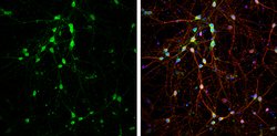 Invitrogen DARPP-32 Polyclonal Antibody 100 &mu;L; Unconjugated:Antibodies,