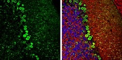 Invitrogen DARPP-32 Polyclonal Antibody 100 &mu;L; Unconjugated:Antibodies,