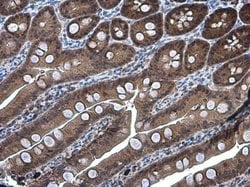 Invitrogen DARPP-32 Polyclonal Antibody 100 &mu;L; Unconjugated:Antibodies,