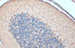 Invitrogen DARPP-32 Polyclonal Antibody 100 &mu;L; Unconjugated:Antibodies,