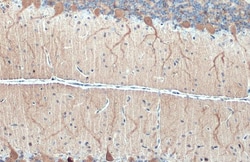 Invitrogen DARPP-32 Polyclonal Antibody 100 &mu;L; Unconjugated:Antibodies,
