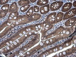 Invitrogen DARPP-32 Polyclonal Antibody 100 &mu;L; Unconjugated:Antibodies,