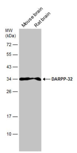 Invitrogen DARPP-32 Polyclonal Antibody 100 &mu;L; Unconjugated:Antibodies,