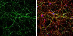 Invitrogen alpha Internexin Polyclonal Antibody 100 &mu;L; Unconjugated:Antibodies,