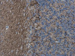 Invitrogen alpha Internexin Polyclonal Antibody 100 &mu;L; Unconjugated:Antibodies,