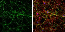 Invitrogen alpha Internexin Polyclonal Antibody 100 &mu;L; Unconjugated:Antibodies,