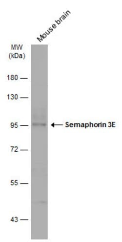 Invitrogen SEMA3E Polyclonal Antibody 100 &mu;L; Unconjugated:Antibodies,