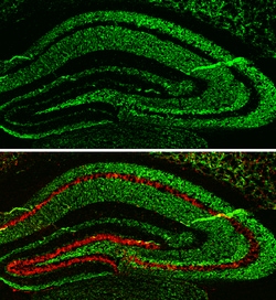 Invitrogen alpha Synuclein Polyclonal Antibody 100 &mu;L; Unconjugated:Antibodies,