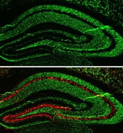 Invitrogen alpha Synuclein Polyclonal Antibody 100 &mu;L; Unconjugated:Antibodies,