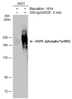 Invitrogen Phospho-EGFR (Tyr992) Polyclonal Antibody 100 &mu;L; Unconjugated:Antibodies,