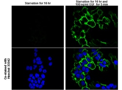 Invitrogen Phospho-EGFR (Tyr1173) Polyclonal Antibody 100 &mu;L; Unconjugated:Antibodies,
