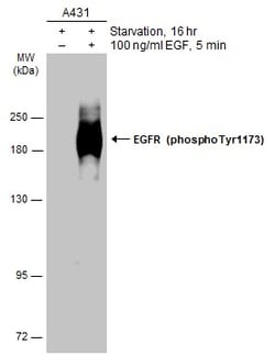 Invitrogen Phospho-EGFR (Tyr1173) Polyclonal Antibody 100 &mu;L; Unconjugated:Antibodies,