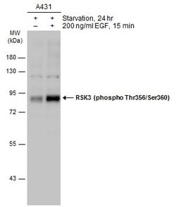 Invitrogen Phospho-RSK3 (Thr356, Ser360) Polyclonal Antibody 100 &mu;L;