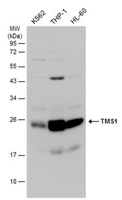 Invitrogen PYCARD Polyclonal Antibody 100 &mu;L; Unconjugated:Antibodies,