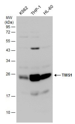 Invitrogen PYCARD Polyclonal Antibody 100 &mu;L; Unconjugated:Antibodies,